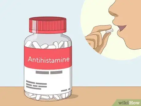 Image titled Soothe Itchy Legs Step 28