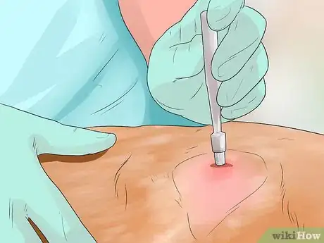 Image titled Diangose Juvenile Renal Dysplasia in Shih Tzus Step 7