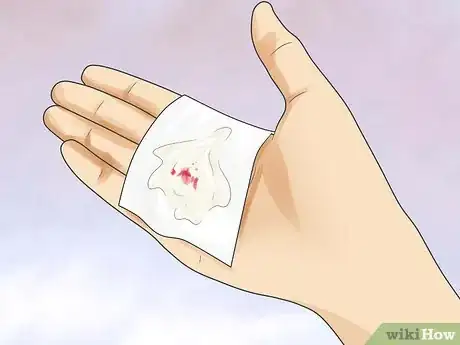 Image titled Know if You Have Prostate Cancer Step 8