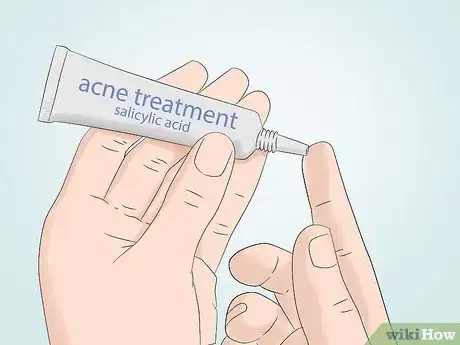 Image titled Clear Pustules on Your Face Step 8