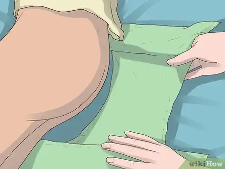 Image titled Change a Cloth Adult Diaper Step 15
