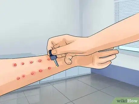 Image titled Know if You Have Esophagitis Step 10