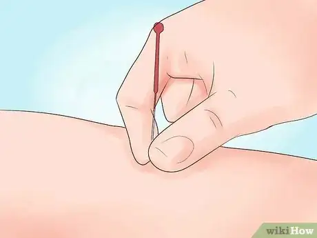 Image titled Get Through a Migraine Step 15