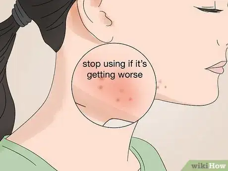 Image titled Use Argan Oil for Acne Step 10