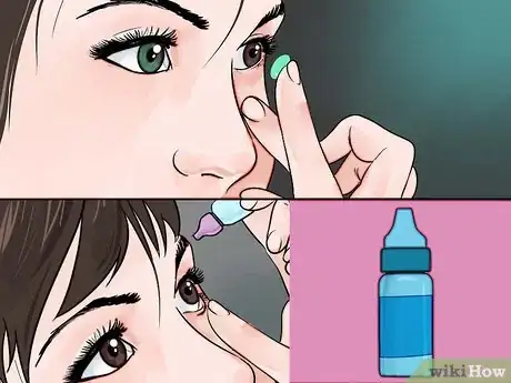 Image titled Care for Dry Eyes Step 13