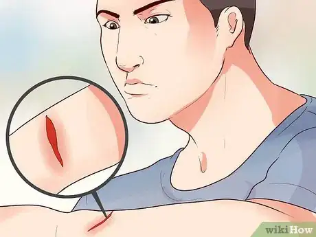 Image titled Camouflage a Scar Step 1