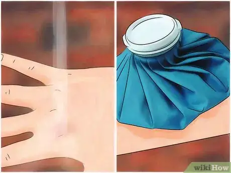 Image titled Identify Fire Ant Stings Step 5