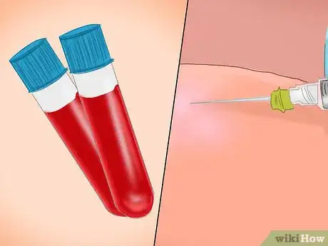 Image titled Prevent Staph Infection Step 13