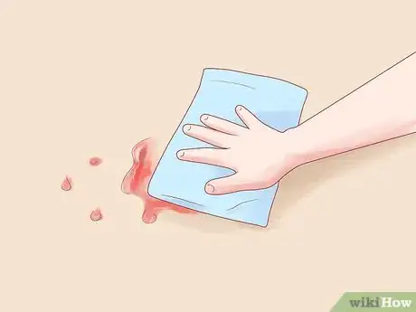 Image titled Deal with a Toddler Nosebleed Step 19