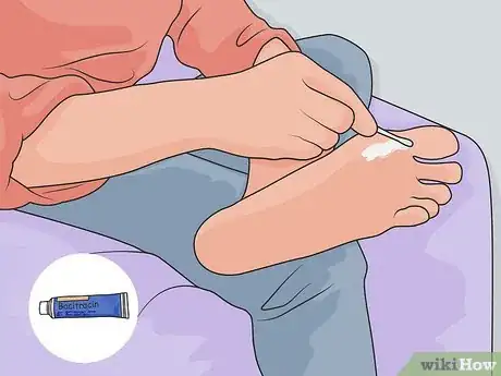 Image titled Treat a Foot Wound Step 04