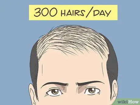 Image titled Deal with Telogen Effluvium Step 2