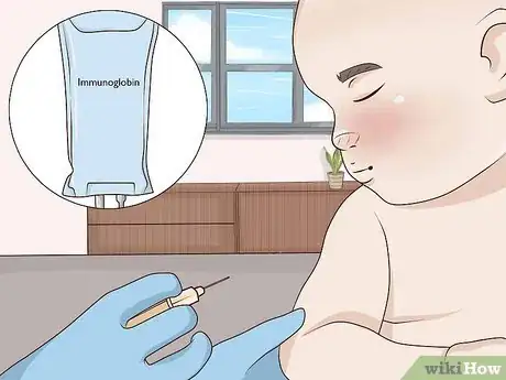 Image titled Treat Jaundice in Babies Step 8