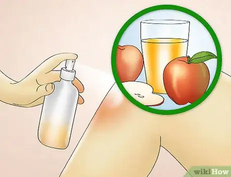 Image titled Reduce Redness After Waxing Step 5