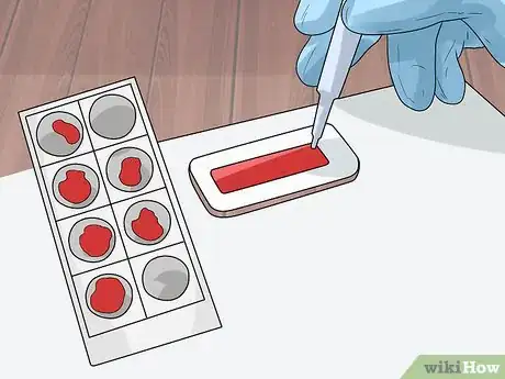 Image titled Diagnose Epilepsy in German Shepherds Step 9