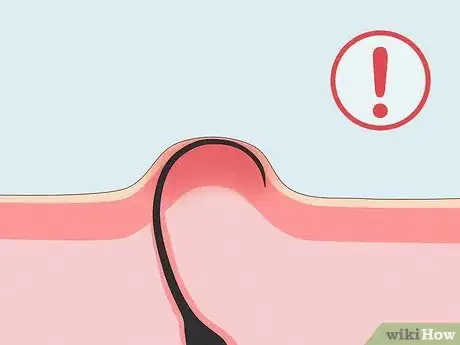 Image titled Is It Ok to Shave Chest Hair Step 3