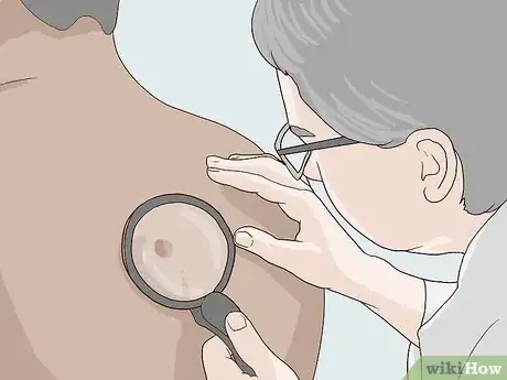 Image titled Determine Fitzpatrick Skin Type Step 12