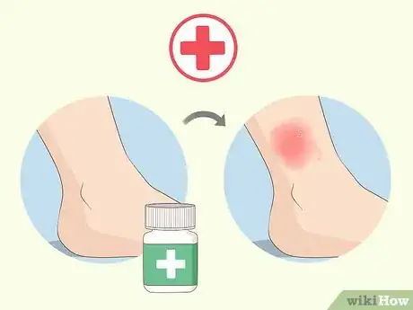 Image titled Soothe Itchy Legs Step 34