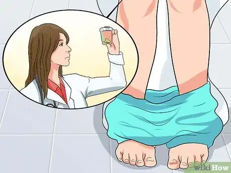 Image titled Screen for Colon Cancer Step 2