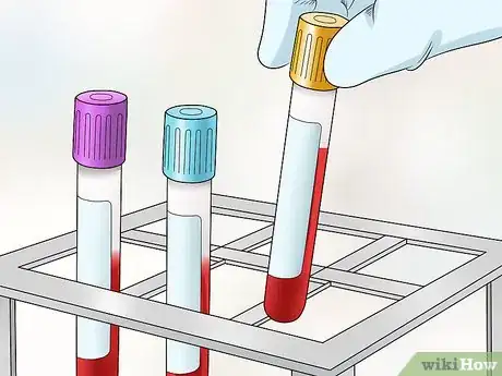 Image titled Check Lymph Nodes Step 11