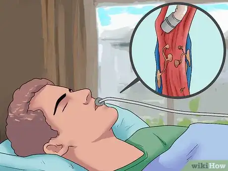 Image titled Test for Upper Gastrointestinal Bleeding Step 10