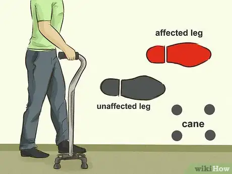 Image titled Use Physical Therapy to Recover From a Stroke Step 17