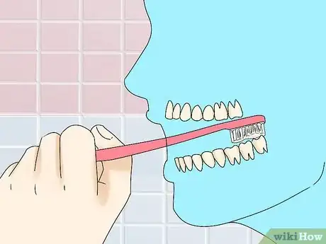 Image titled Clean Wisdom Teeth Step 5