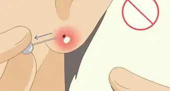 Treat Infected Piercings