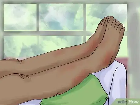 Image titled Care for a Tattoo During Removal Step 7