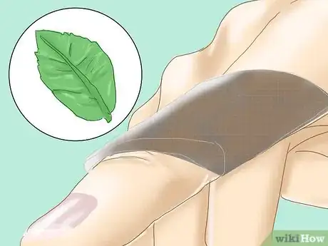 Image titled Treat a Paper Cut Step 15