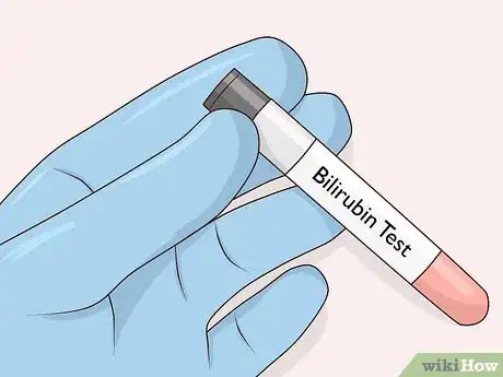 Image titled Treat Jaundice in Babies Step 2