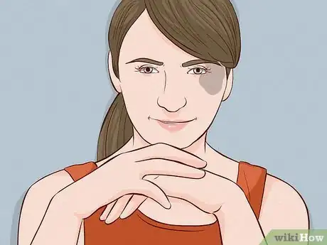 Image titled Deal With Birthmarks Step 2