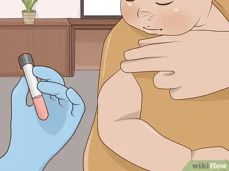 Image titled Treat Jaundice in Babies Step 3