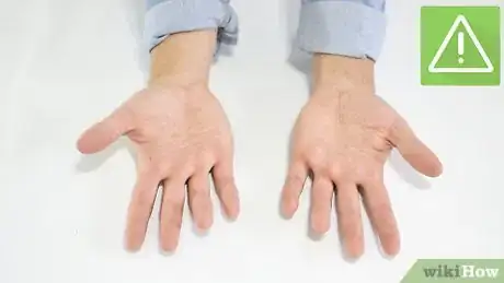 Image titled Broil Step 4