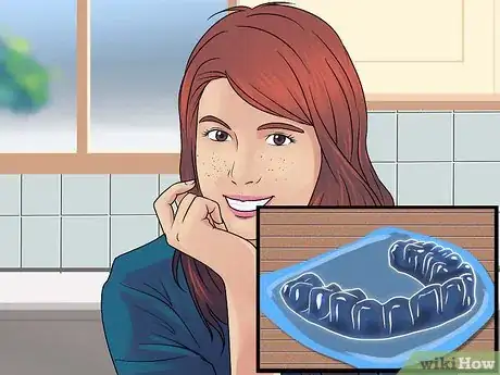 Image titled Get Straight Teeth Without Braces with Invisalign Step 15