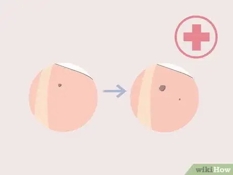 Image titled Get Fair Skin Naturally Step 17