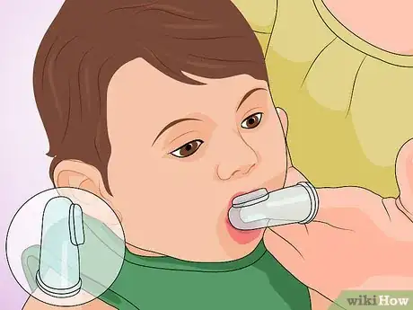 Image titled Protect Your Child's Teeth Step 2