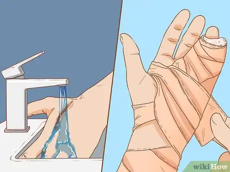 Image titled Apply Different Types of Bandages Step 16