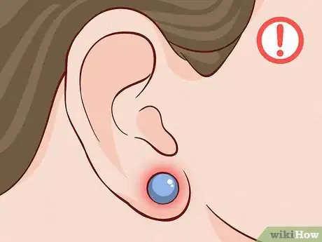 Image titled Care for Sensitive Skin Step 11