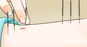 Treat Mild Depression