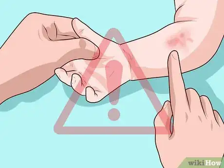 Image titled Safely Vaccinate Your Child Step 7