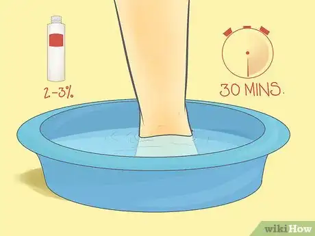 Image titled Use Foot Baths for Athlete’s Foot Step 2