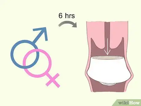 Image titled Use a Cervical Cap Step 7