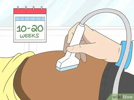 Image titled Diagnose Spinal Muscular Atrophy Step 9