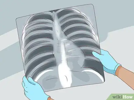 Image titled Identify Atrial Fibrillation Step 18