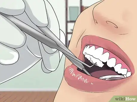 Image titled Treat a Fat Lip Step 1