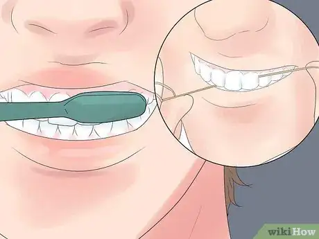 Image titled Cure Dry Mouth Step 12