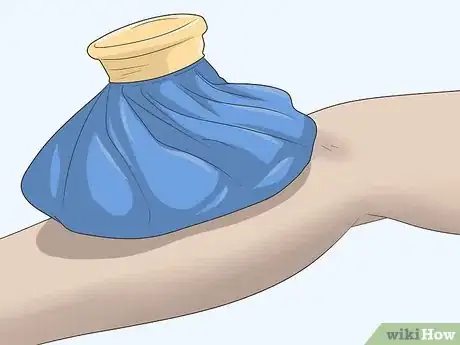 Image titled Prevent Shin Splints when Running Step 13