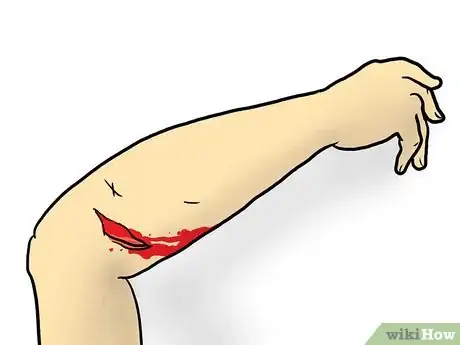 Image titled Complete a Top to Toe Assessment of an Injury Step 14