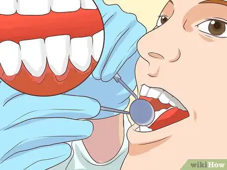 Image titled Take Lifestyle Precautions for Hemophilia Step 8