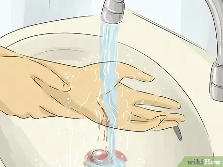 Image titled Avoid Armpit Swelling Step 2